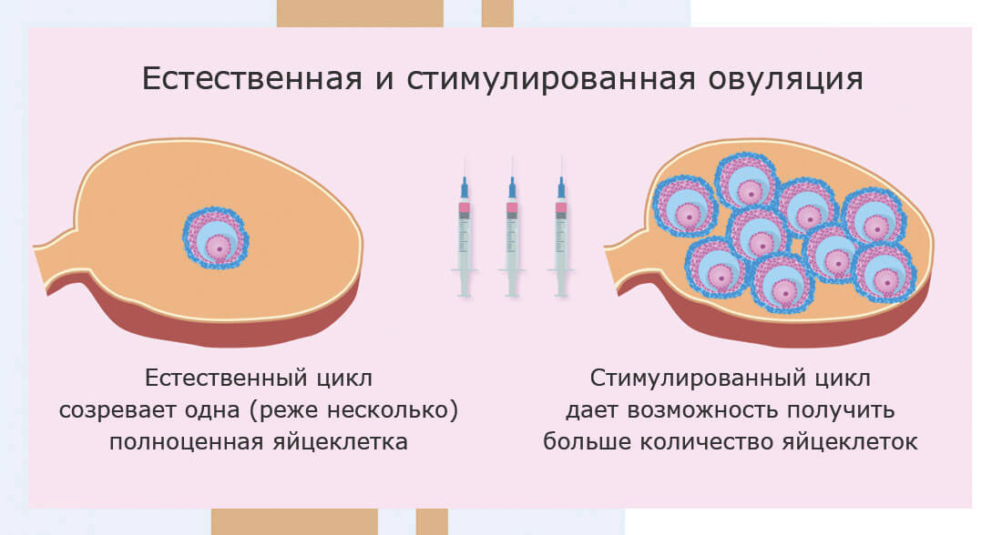 Если не получается зачать ребенка: методы стимуляции овуляции