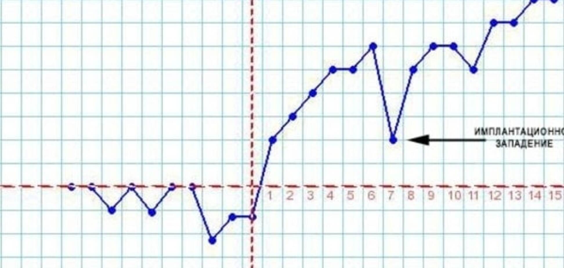 Имплантационное западение базальной температуры