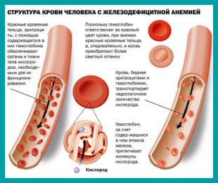 Как анемия мешает зачатию?